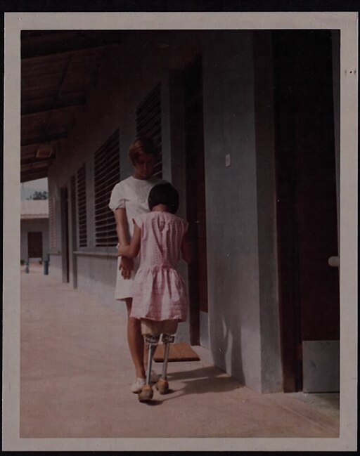 Krankenschwester hilft einem vietnamesischen Kind mit Amputationen im Qui Nhon Rehabilitationszentrum, 1969